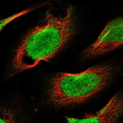 CHD1L Antibody, Novus Biologicals 25 &mu;L; Unlabeled:Antibodies, Polyclonal