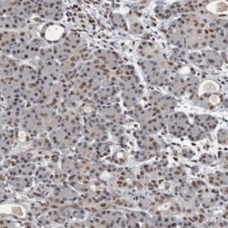 CHD1L Antibody, Novus Biologicals 25 &mu;L; Unlabeled:Antibodies, Polyclonal