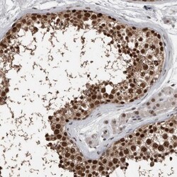 CHD1L Antibody, Novus Biologicals 25 &mu;L; Unlabeled:Antibodies, Polyclonal