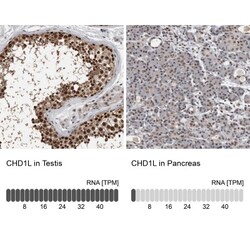 CHD1L Antibody, Novus Biologicals 25 &mu;L; Unlabeled:Antibodies, Polyclonal
