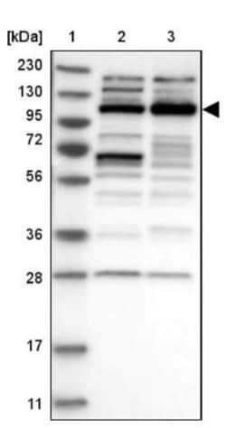CHD1L Antibody, Novus Biologicals 25 &mu;L; Unlabeled:Antibodies, Polyclonal