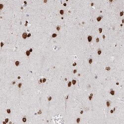 CHD2 Antibody, Novus Biologicals 25 &mu;L, Unlabeled:Antibodies, Polyclonal