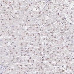 CHD2 Antibody, Novus Biologicals 25 &mu;L, Unlabeled:Antibodies, Polyclonal