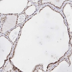 CHD2 Antibody, Novus Biologicals 25 &mu;L, Unlabeled:Antibodies, Polyclonal