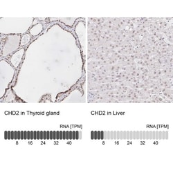 CHD2 Antibody, Novus Biologicals 25 &mu;L, Unlabeled:Antibodies, Polyclonal