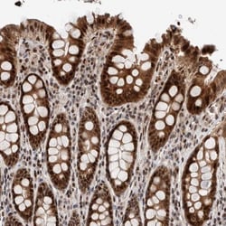 CHD4 Antibody, Novus Biologicals:Antibodies:Primary Antibodies