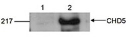 CHD5 Rabbit anti-Human, Polyclonal, Novus Biologicals 100 &mu;g; Unconjugated:Antibodies,