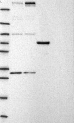 CHD8 Rabbit anti-Human, Polyclonal, Novus Biologicals 100 &mu;g; Unconjugated:Antibodies,