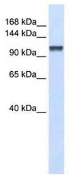 CHERP Antibody, Novus Biologicals 100 &mu;g; Unconjugated:Antibodies, Polyclonal