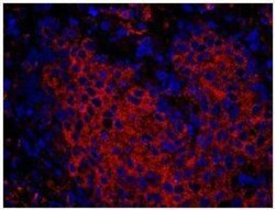 CHIP/STUB1 Antibody, Novus Biologicals 0.1mg; Unlabeled:Antibodies, Polyclonal