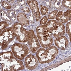 CHIP/STUB1 Antibody, Novus Biologicals:Antibodies:Primary Antibodies