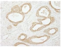 CHIP/STUB1 Antibody, Novus Biologicals 0.1mg; Unlabeled:Antibodies, Polyclonal