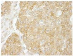 CHIP/STUB1 Antibody, Novus Biologicals 0.1mg; Unlabeled:Antibodies, Polyclonal