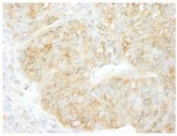 CHIP/STUB1 Antibody, Novus Biologicals 0.1mg; Unlabeled:Antibodies, Polyclonal