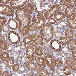CHIP/STUB1 Antibody, Novus Biologicals:Antibodies:Primary Antibodies