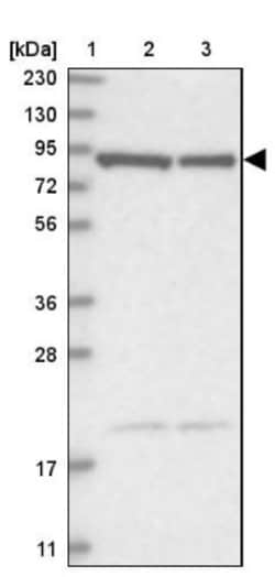 CHML Antibody, Novus Biologicals:Antibodies:Primary Antibodies