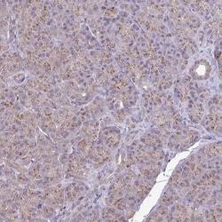 CHMP1B Antibody, Novus Biologicals:Antibodies:Primary Antibodies