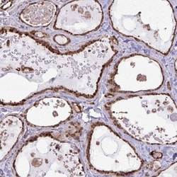 CHMP1B Antibody, Novus Biologicals:Antibodies:Primary Antibodies