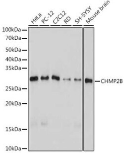 CHMP2B Rabbit anti-Human, Mouse, Rat, Clone: 3L9O5, Novus Biologicals 20 &mu;g | Buy Online | Novus Biologicals | Fisher Scientific