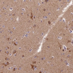 CHMP4B Antibody, Novus Biologicals 0.1mL; Unlabeled:Antibodies, Polyclonal