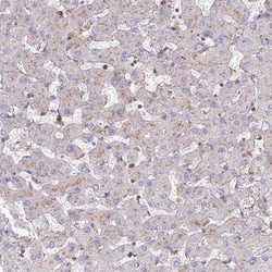 CHMP4B Antibody, Novus Biologicals 0.1mL; Unlabeled:Antibodies, Polyclonal