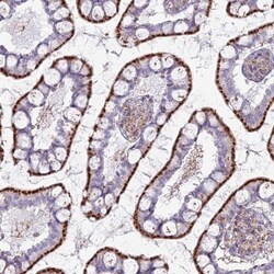 CHMP4B Antibody, Novus Biologicals 0.1mL; Unlabeled:Antibodies, Polyclonal