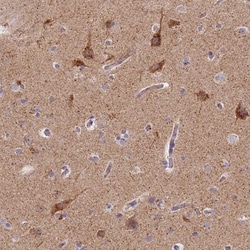CHMP4B Antibody, Novus Biologicals 0.1mL; Unlabeled:Antibodies, Polyclonal