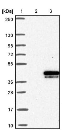 CHMP4B Antibody, Novus Biologicals 0.1mL; Unlabeled:Antibodies, Polyclonal