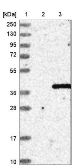 CHMP4C Antibody, Novus Biologicals 25ul | Buy Online | Novus Biologicals | Fisher Scientific