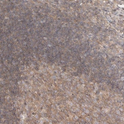 CHMP6 Antibody, Novus Biologicals 25 &mu;L; Unlabeled:Antibodies, Polyclonal