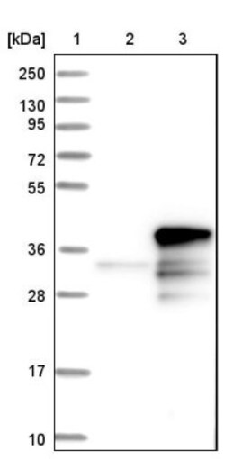 CHMP6 Antibody, Novus Biologicals 25 &mu;L; Unlabeled:Antibodies, Polyclonal
