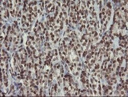 CHN 1 Antibody (OTI2G6), Novus Biologicals 0.1mL; Unlabeled:Antibodies,
