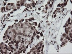 CHN 1 Antibody (OTI2G6), Novus Biologicals 0.1mL; Unlabeled:Antibodies,