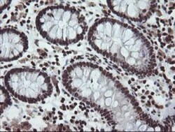 CHN 1 Antibody (OTI2G6), Novus Biologicals 0.1mL; Unlabeled:Antibodies,