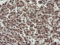 CHN 1 Antibody (OTI2G6), Novus Biologicals 0.1mL; Unlabeled:Antibodies,