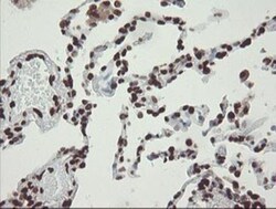 CHN 1 Antibody (OTI2G6), Novus Biologicals 0.1mL; Unlabeled:Antibodies,