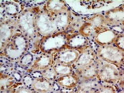 CHREBP Antibody (2D9NB) - BSA Free, Novus Biologicals:Antibodies:Primary
