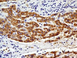 CHREBP Antibody (2D9NB) - BSA Free, Novus Biologicals:Antibodies:Primary