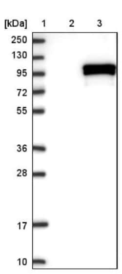 CHSS2 Antibody, Novus Biologicals 0.1mL; Unlabeled:Antibodies, Polyclonal