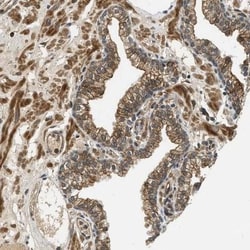 CHST8 Antibody, Novus Biologicals 25 &mu;L; Unlabeled:Antibodies, Polyclonal