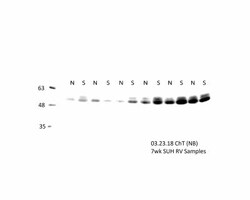 CHT1 Antibody (62-2E8), Novus Biologicals:Antibodies:Primary Antibodies