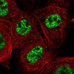 CHTOP Antibody, Novus Biologicals 25 &mu;L; Unlabeled:Antibodies, Polyclonal
