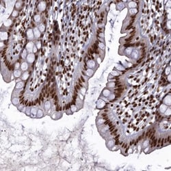 CHTOP Antibody, Novus Biologicals 25 &mu;L; Unlabeled:Antibodies, Polyclonal