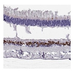 CHX10 Antibody, Novus Biologicals:Antibodies:Primary Antibodies