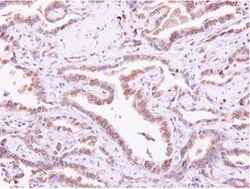 CIB1 Antibody, Novus Biologicals 0.1mg; Unlabeled:Antibodies, Polyclonal