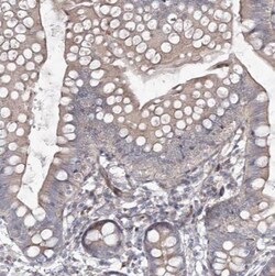 CIB2 Antibody, Novus Biologicals 0.1mL; Unlabeled:Antibodies, Polyclonal