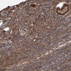 CILP-1 Antibody, Novus Biologicals 0.1mL; Unlabeled:Antibodies, Polyclonal