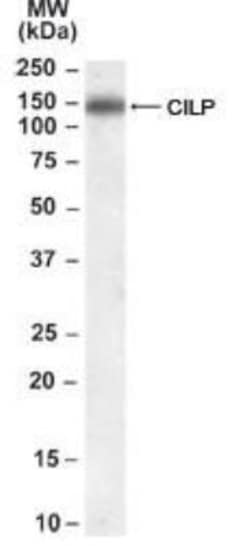 CILP-1 Antibody, Novus Biologicals 0.1mg; Unlabeled:Antibodies, Polyclonal