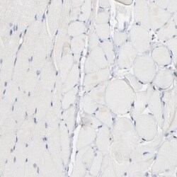 CIN85/SH3KBP1 Antibody, Novus Biologicals:Antibodies:Primary Antibodies