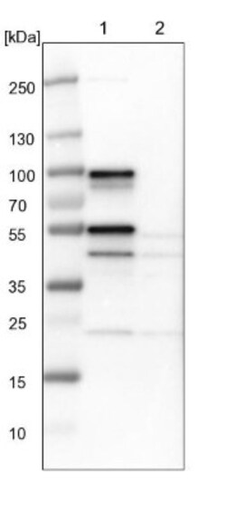 CIN85/SH3KBP1 Antibody, Novus Biologicals:Antibodies:Primary Antibodies